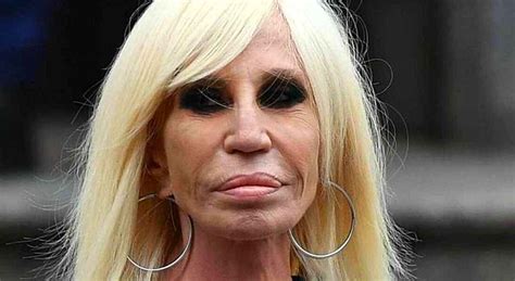 versace prima della chirurgia